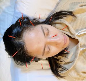 Adrianne gives herself facial acupuncture in El Paso, TX